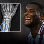 Trabzonspor’dan Onuachu tepkisi: Röntgen görüntüsü paylaşıldı